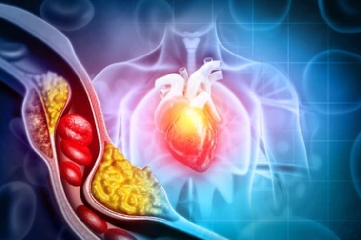 Cardiovascular Diseases