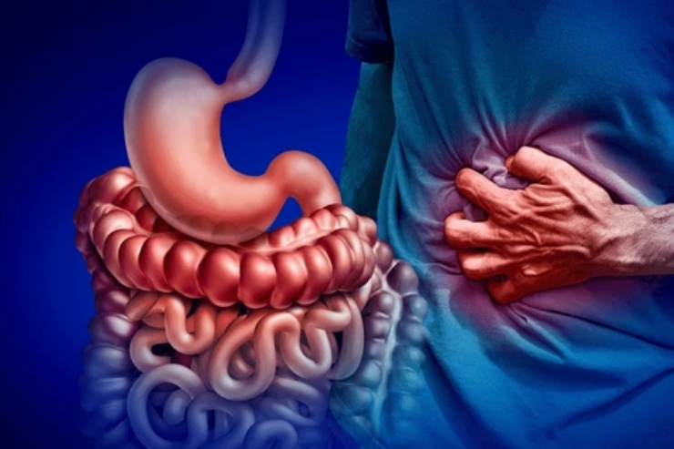 Gastrointestinal Diseases