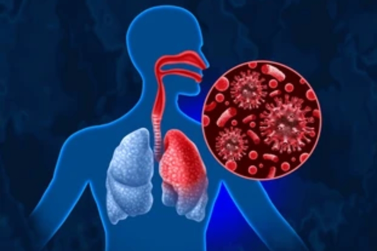 Respiratory Diseases
